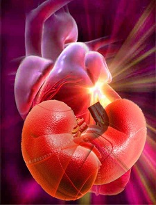 El riñon y el corazón: ¿En qué consiste síndrome cardiorrenal?