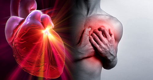 Subtipos de Hipertensión según la Monitorización ambulatoria de la presión arterial y enfermedad cardiovascular