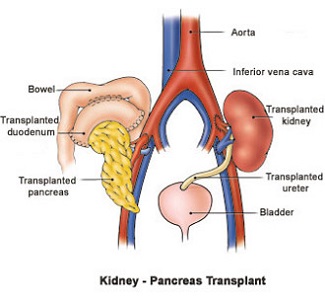 ¿Por qué es importante el páncreas?