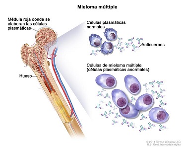 Células «entrenadas» del sistema inmune logran controlar el mieloma
