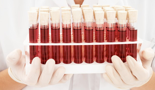 En la insuficiencia renal crónica: ¿Hay anemia?