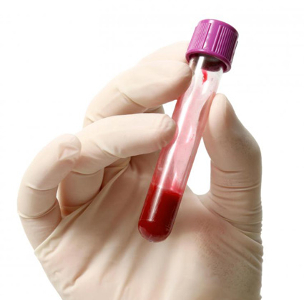 Anemia renal y agentes estimulantes de la eritropoyesis