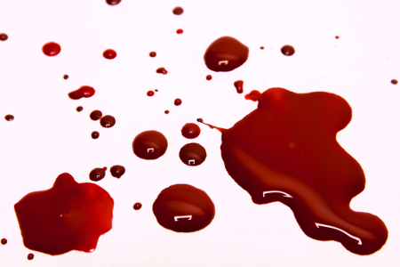 ¿Qué hacer si sangro por la fístula en casa?